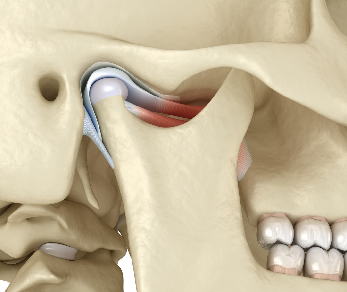 6 Signs That You May Have TMJ Disorder